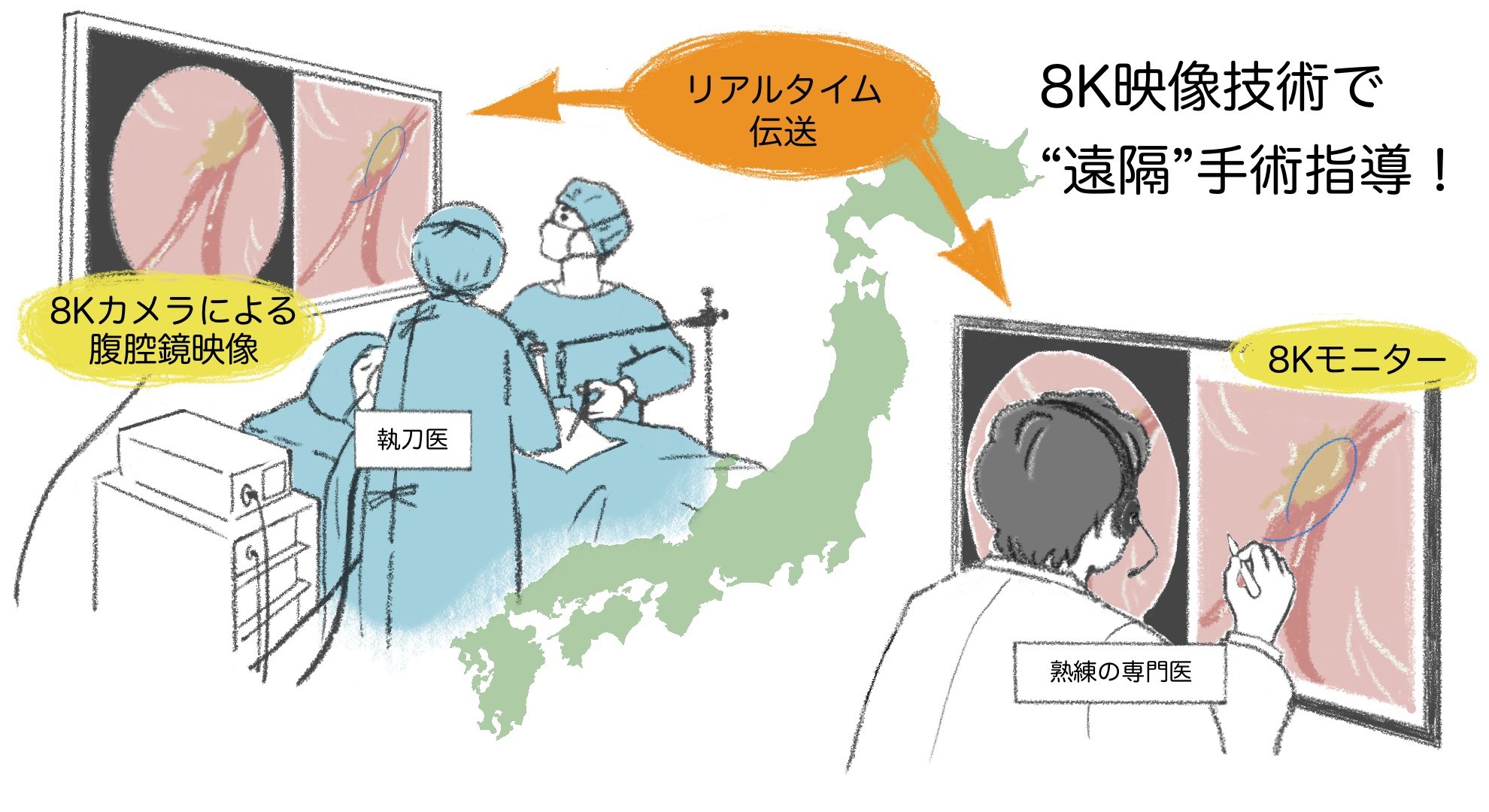 世界初！8K映像を活用した遠隔指導による腹腔鏡手術の臨床試験に成功